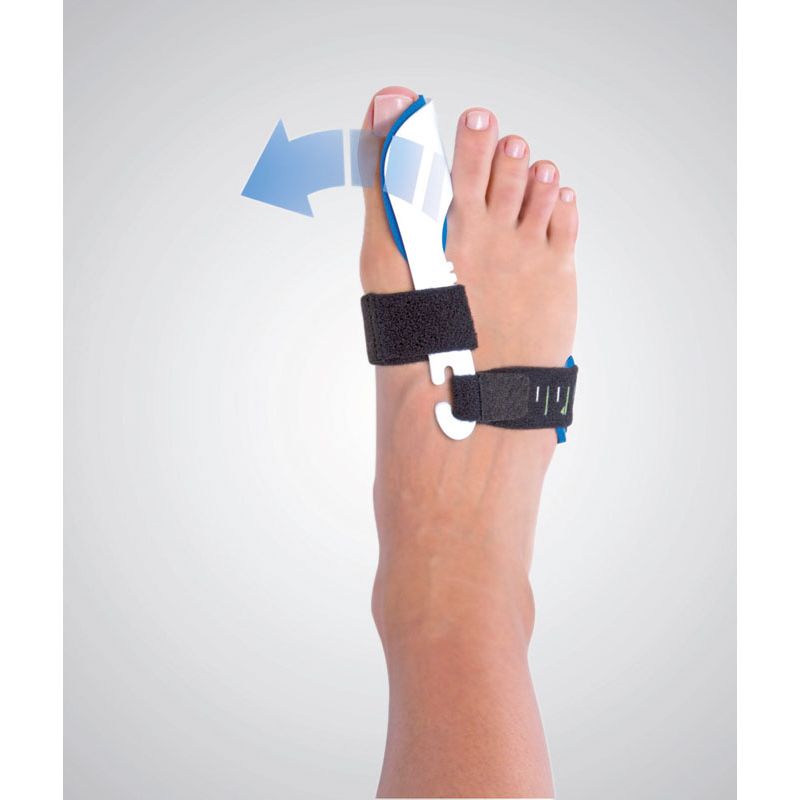 Valgus Control – Image 2